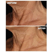 Thumbnail for Dermalogica Neck fit contour serum before after